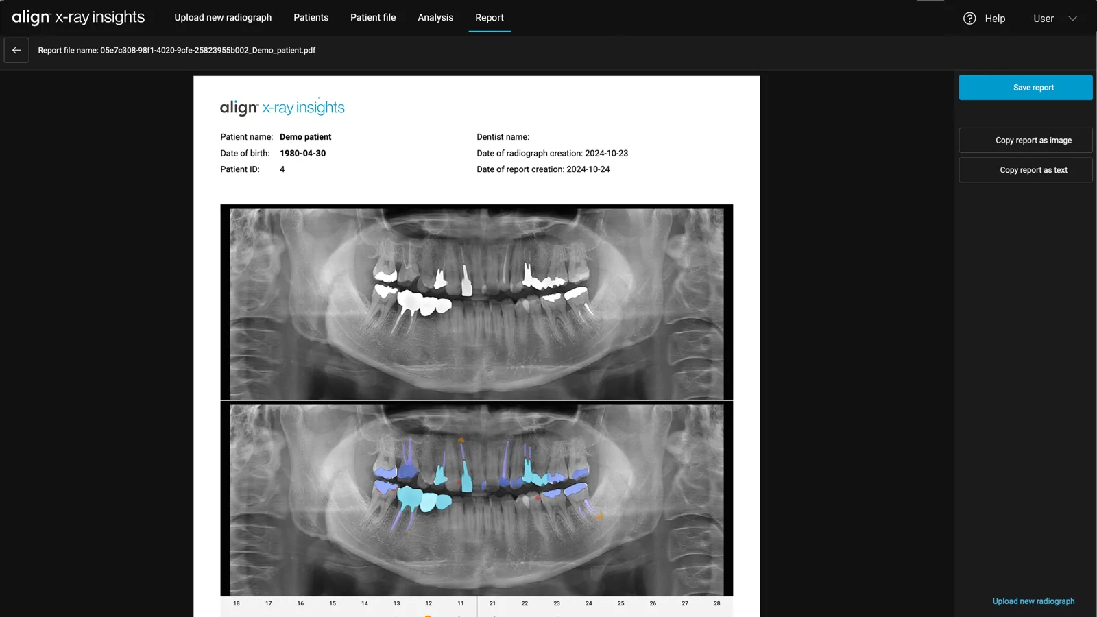 DentalXR.AI report view with annotated panoramic radiograph