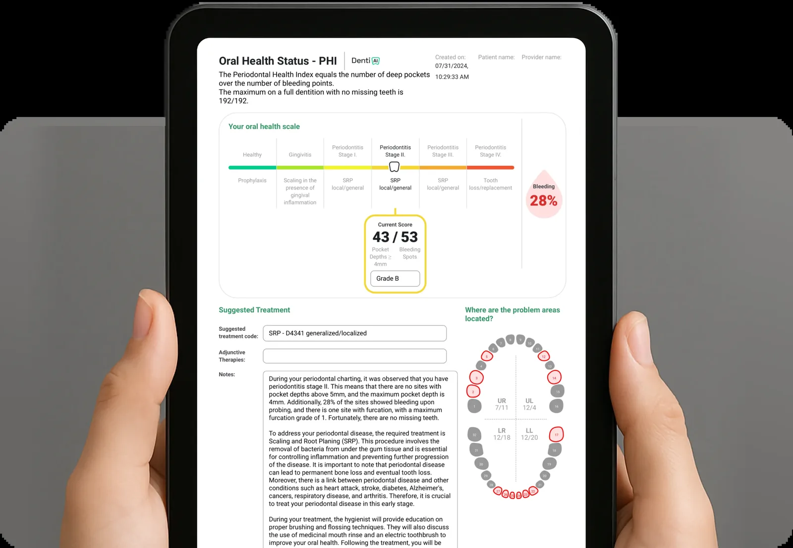 Denti.AI patient oral health report on a tablet