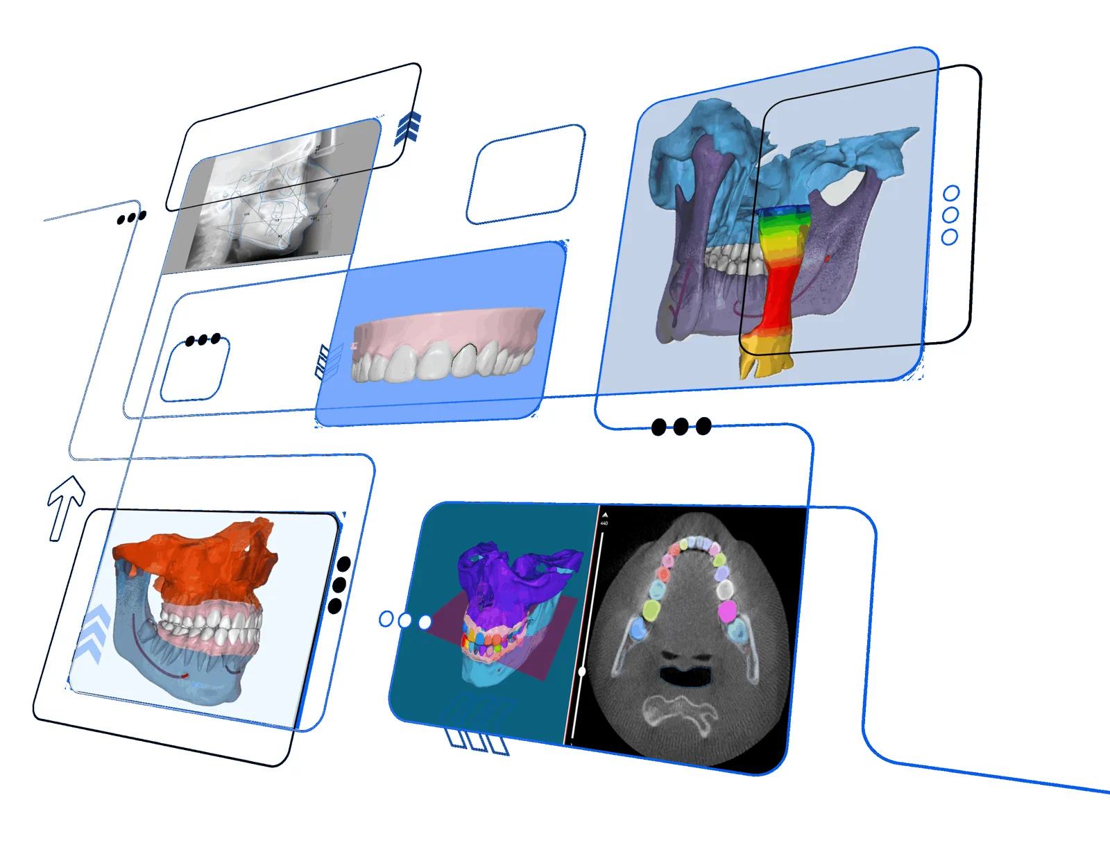 Orca Dental AI views: radiographs, intraoral scan and segmented 3D CBCT models